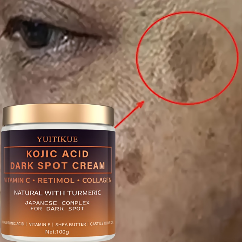 Retinol Vitamin A Cream - Krim pemudar arbutin, Vitamin C, retinol,
