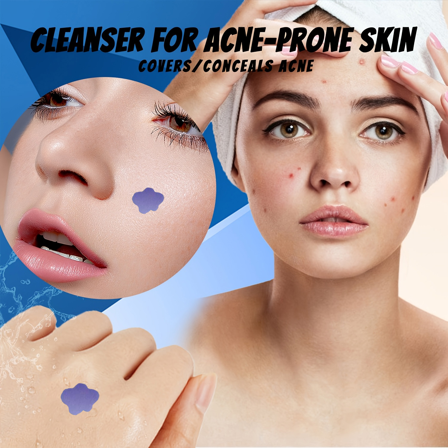 Microneedle Acne Pimple Patch  - Skincare Acne ulasan dan harga