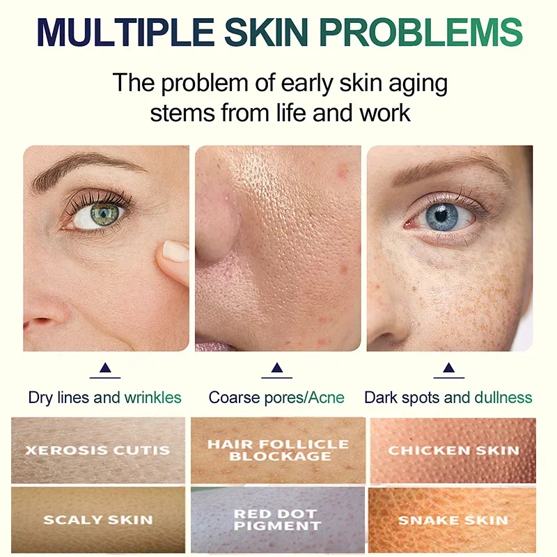 Serum Pengelupas Wajah Asam Sa - Glycolic Acid Exfoliant ulasan dan harga