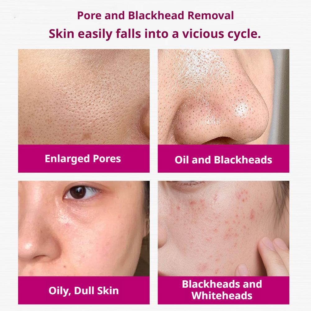 Serum Asam Salisilat Mengecilk - Glycolic Acid Exfoliant ulasan dan harga