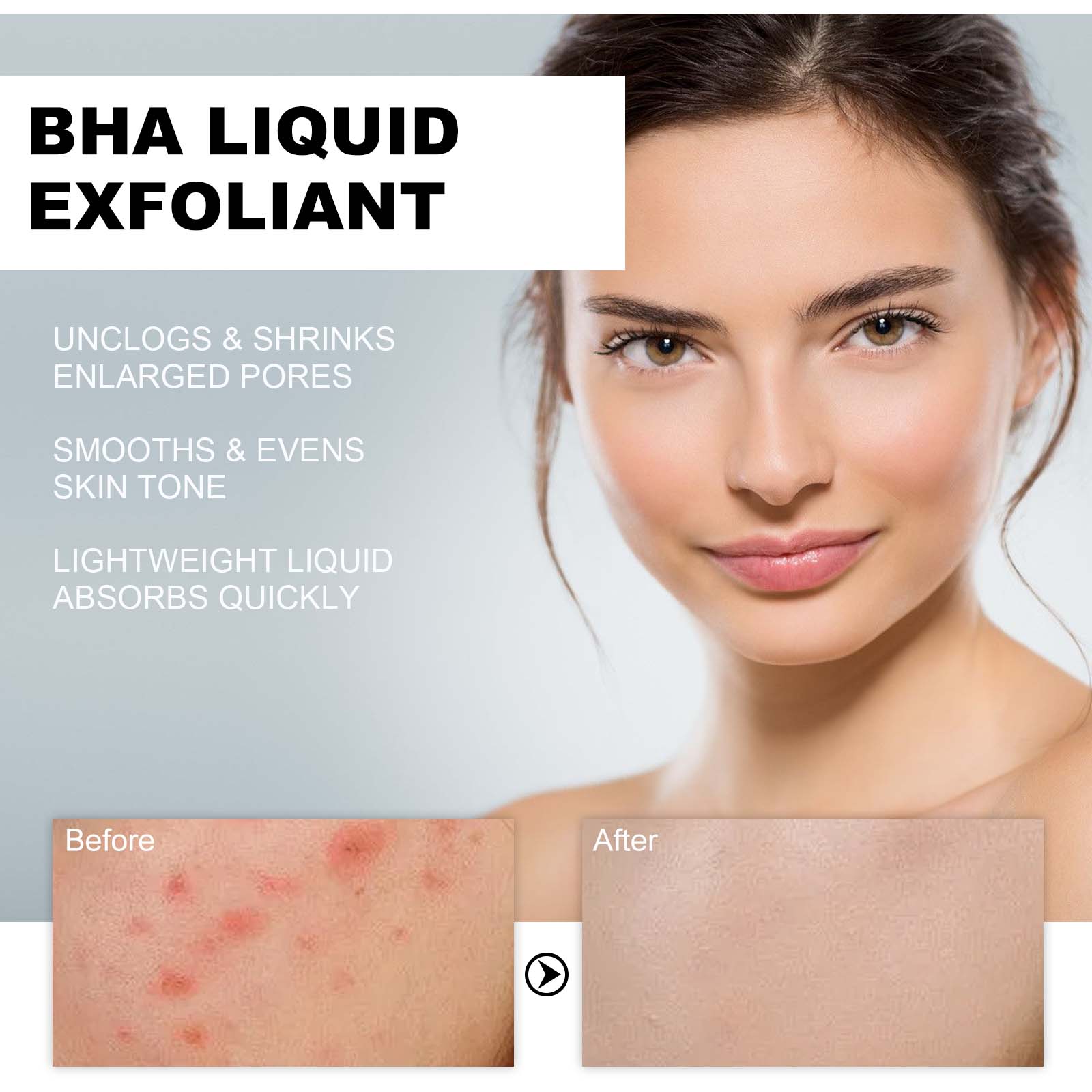 Serum Pengencang Pori-pori den - Glycolic Acid Exfoliant ulasan dan harga