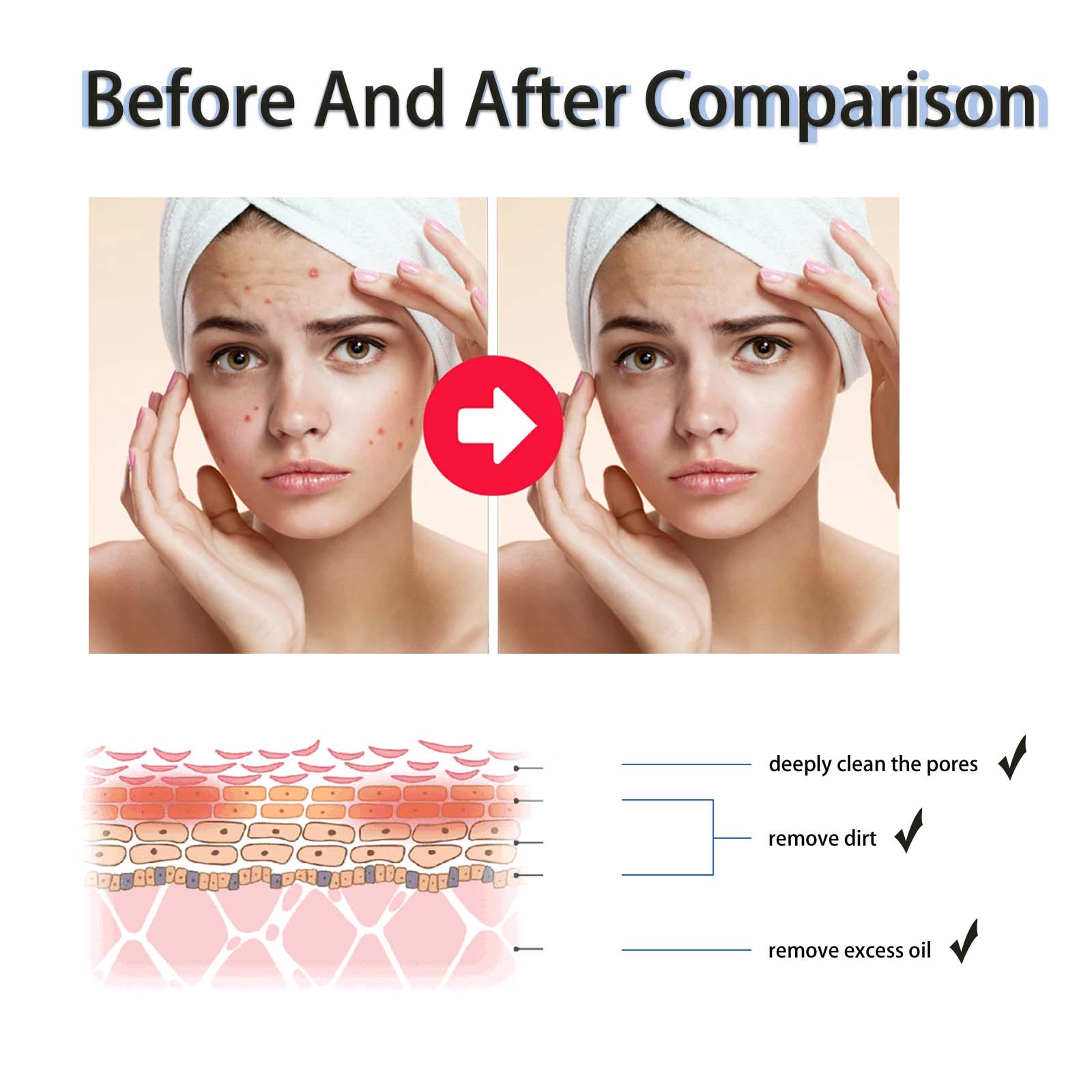 Serum Pengencang Pori-pori den - Glycolic Acid Exfoliant ulasan dan harga