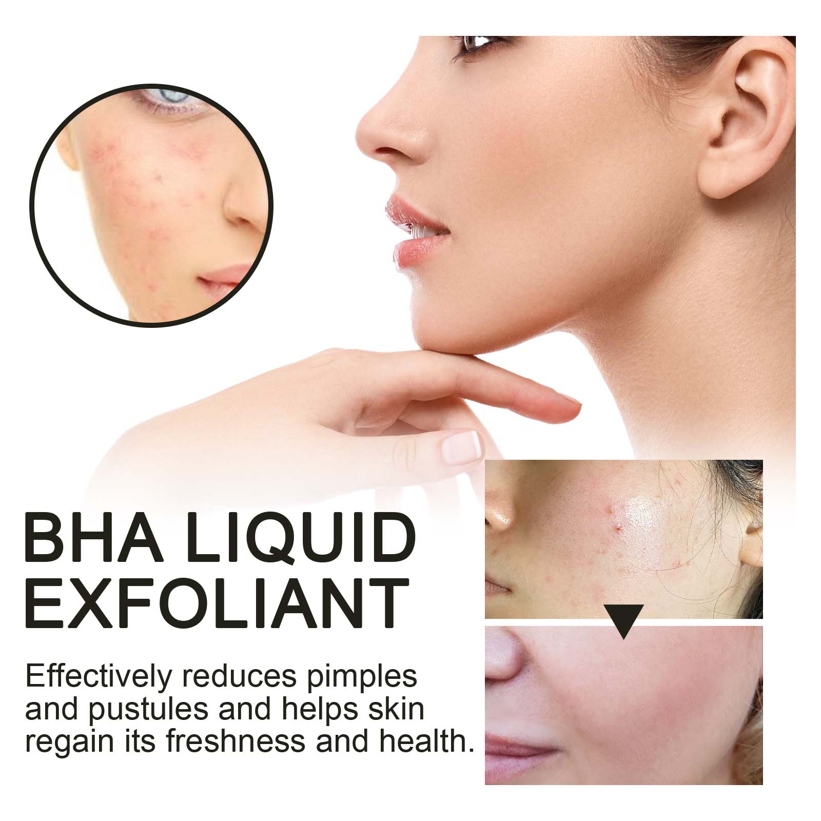 Serum Pengencang Pori-pori den - Glycolic Acid Exfoliant ulasan dan harga